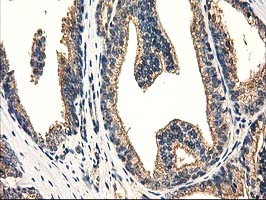 m03123 1 anti catalase cat mouse monoclonal antibody clone id oti1b8 ihc testing 8