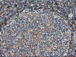 m03123 1 anti catalase cat mouse monoclonal antibody clone id oti1b8 ihc testing 9