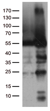 m03123 1 anti catalase cat mouse monoclonal antibody clone id oti1b8 wb testing 1