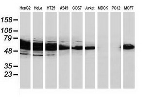 m03123 1 anti catalase cat mouse monoclonal antibody clone id oti1b8 wb testing 2