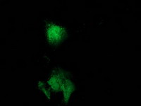 m03123 2 anti catalase cat mouse monoclonal antibody clone id oti1b6 if testing 14