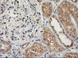 m03123 2 anti catalase cat mouse monoclonal antibody clone id oti1b6 ihc testing 10
