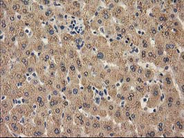 m03123 2 anti catalase cat mouse monoclonal antibody clone id oti1b6 ihc testing 11