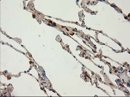 m03123 2 anti catalase cat mouse monoclonal antibody clone id oti1b6 ihc testing 12