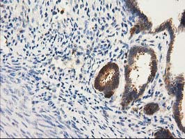 m03123 2 anti catalase cat mouse monoclonal antibody clone id oti1b6 ihc testing 5