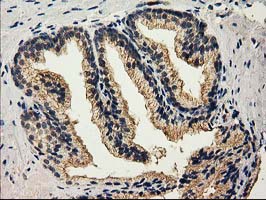 m03123 2 anti catalase cat mouse monoclonal antibody clone id oti1b6 ihc testing 6