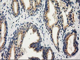 m03123 2 anti catalase cat mouse monoclonal antibody clone id oti1b6 ihc testing 7