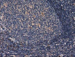 m03123 2 anti catalase cat mouse monoclonal antibody clone id oti1b6 ihc testing 8