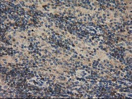 m03123 2 anti catalase cat mouse monoclonal antibody clone id oti1b6 ihc testing 9