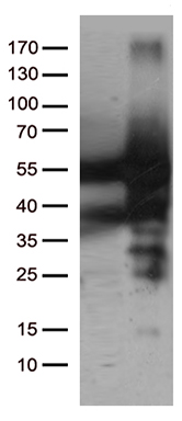 HEK293T cells were transfected with the pCMV6-ENTRY control (Left lane) or pCMV6-ENTRY CAT (Right lane) cDNA for 48 hrs and lysed