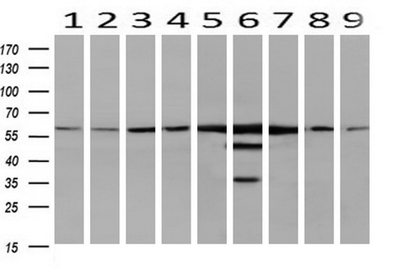 Western blot analysis of extracts (10ug) from 9 Human tissue by using anti-CAT monoclonal antibody at 1:200 (1: Testis; 2: Omentum; 3: Uterus; 4: Breast; 5: Brain; 6: Liver; 7: Ovary; 8: Thyroid gland; 9: colon)