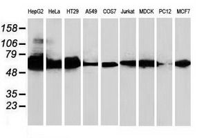 Western blot analysis of extracts (35ug) from 9 different cell lines by using anti-CAT monoclonal antibody (1:500)