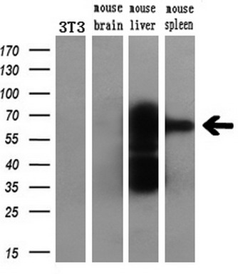 m03123 2 anti catalase cat mouse monoclonal antibody clone id oti1b6 wb testing 4