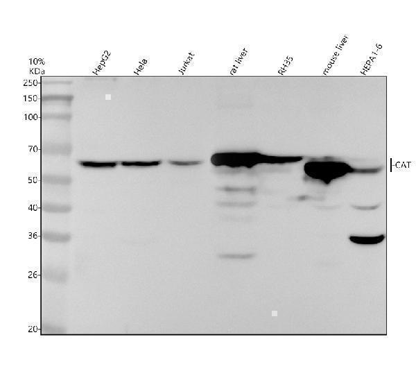Western blot analysis of CAT using anti-CAT antibody (M03123)