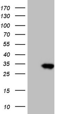 HEK293T cells were transfected with the pCMV6-ENTRY control (Left lane) or pCMV6-ENTRY TNFRSF18 (Right lane) cDNA for 48 hrs and lysed