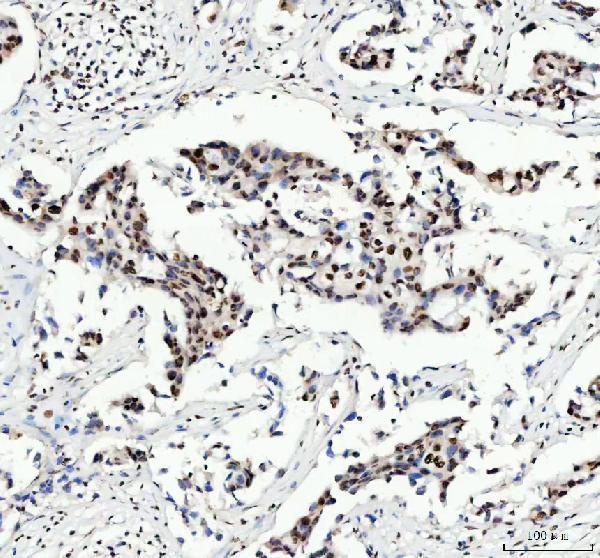 m03126 fubp1 primary antibodies ihc testing 2