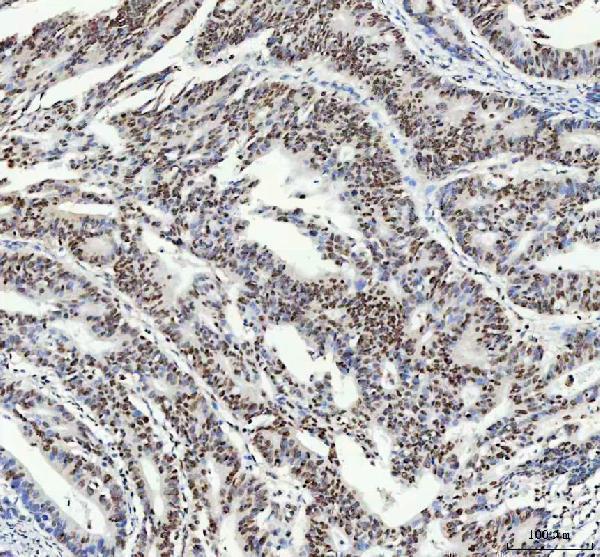 m03126 fubp1 primary antibodies ihc testing 3