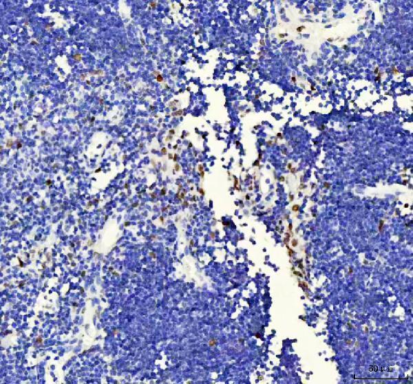 m03126 fubp1 primary antibodies ihc testing 4