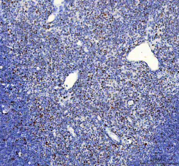 m03126 fubp1 primary antibodies ihc testing 5