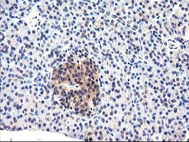 Immunohistochemical staining of paraffin-embedded Human pancreas tissue within the normal limits using anti-CYP2J2 mouse monoclonal antibody