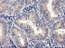 m03128 anti cytochrome p450 2j2 cyp2j2 mouse monoclonal antibody clone id oti5c5 ihc testing 5