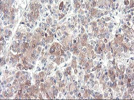 m03128 anti cytochrome p450 2j2 cyp2j2 mouse monoclonal antibody clone id oti5c5 ihc testing 7