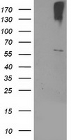 HEK293T cells were transfected with the pCMV6-ENTRY control (Left lane) or pCMV6-ENTRY CYP2J2 (Right lane) cDNA for 48 hrs and lysed