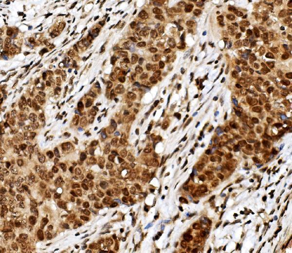  IHC analysis of TIF1 gamma/TRIM33 using anti TIF1 gamma/TRIM33 antibody (M03133-2)