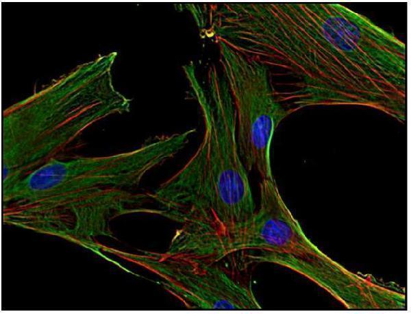 m03134 1 clathrin heavy chain primary antibodies icc testing 2
