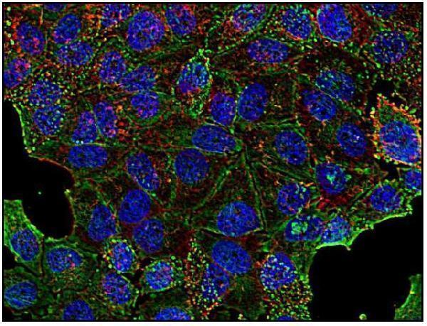 m03134 1 clathrin heavy chain primary antibodies icc testing 3