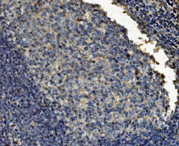 m03134 2 cltc primary antibodies ihc testing 4