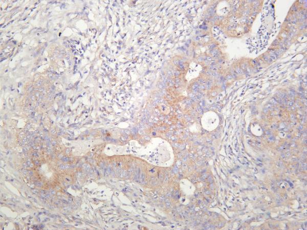 m03134 4 ctlc primary antibodies ihc testing 2