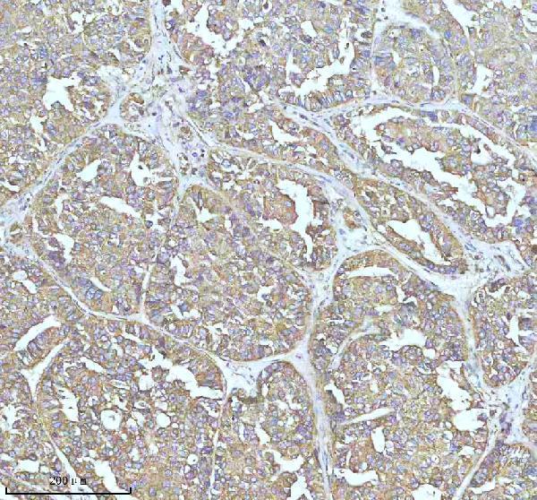  IHC analysis of CLTC using anti-CLTC antibody (M03134)