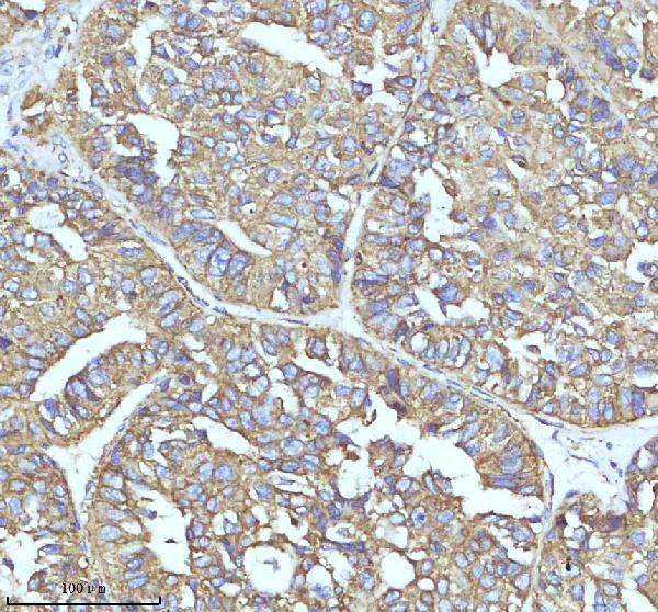  IHC analysis of CLTC using anti-CLTC antibody (M03134)