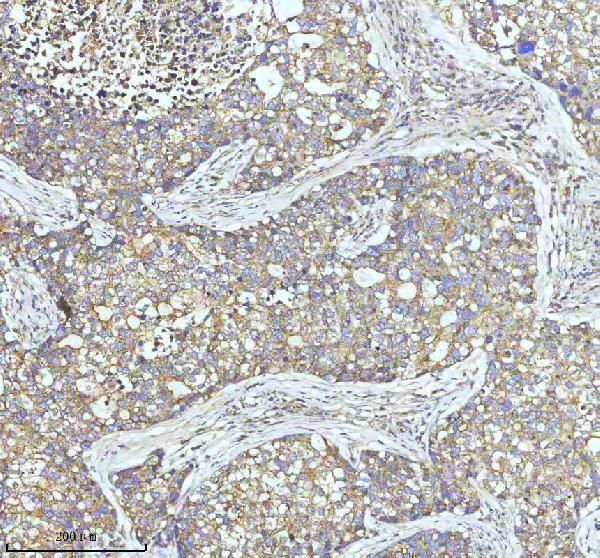 m03134 cltc primary antibodies ihc testing 4