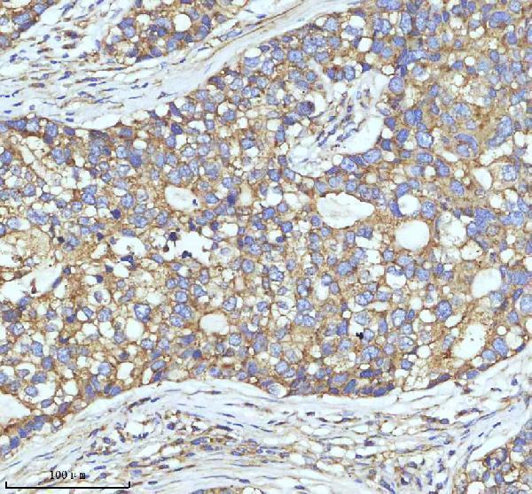 m03134 cltc primary antibodies ihc testing 5