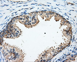 m03135 1 anti rhogdi arhgdia mouse monoclonal antibody clone id oti1a7 ihc testing 3