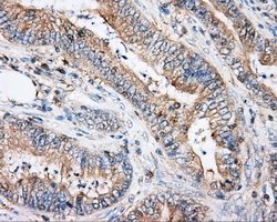 m03135 1 anti rhogdi arhgdia mouse monoclonal antibody clone id oti1a7 ihc testing 4