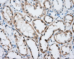 m03135 1 anti rhogdi arhgdia mouse monoclonal antibody clone id oti1a7 ihc testing 5