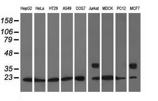 m03135 anti rhogdi arhgdia mouse monoclonal antibody clone id oti1f2 wb testing 2
