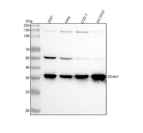  Western blot analysis of DDAH1 using anti-DDAH1 antibody (M03136)