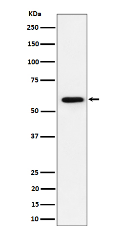 Western blot analysis of PRPF31 expression in Jurkat cell lysate