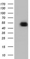 HEK293T cells were transfected with the pCMV6-ENTRY control (Left lane) or pCMV6-ENTRY ODC1 (Right lane) cDNA for 48 hrs and lysed