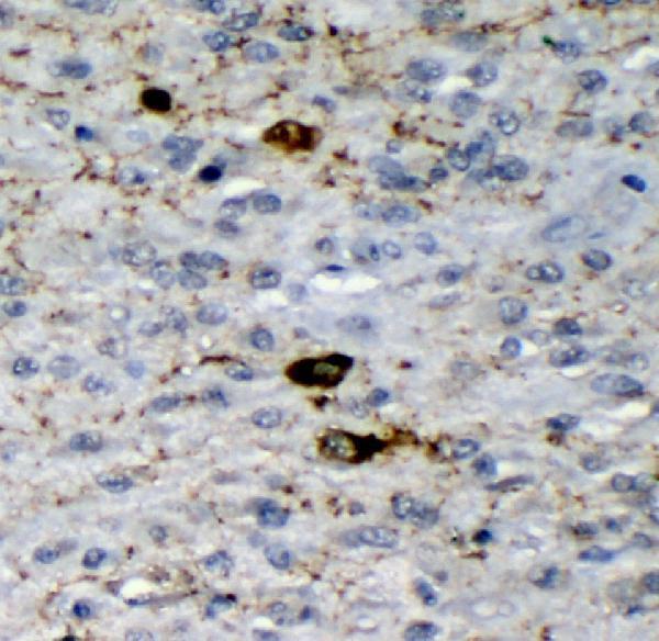  IHC analysis of GAD65/GAD2 using anti-GAD65/GAD2 antibody (M03142)