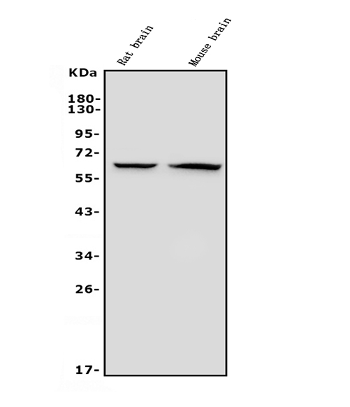  Western blot analysis of GAD65/GAD2 using anti-GAD65/GAD2 antibody (M03142)