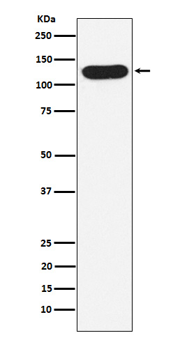 Western blot analysis of Nicastrin expression in A431 cell lysate