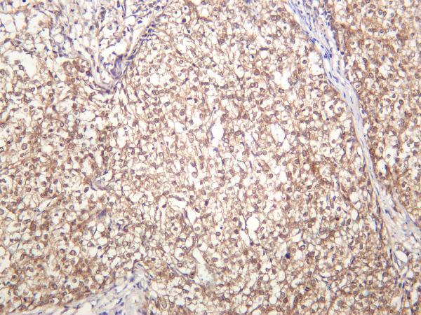 m03152 2 gsk3a primary antibodies ihc testing 1