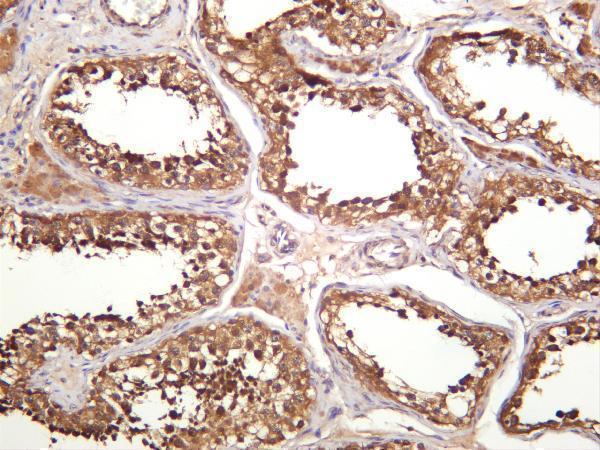 Human testis was stained with anti-GSK3 α/β rabbit antibody