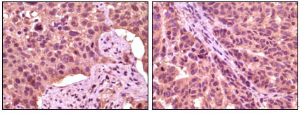 m03152 gsk3a primary antibodies ihc testing 1