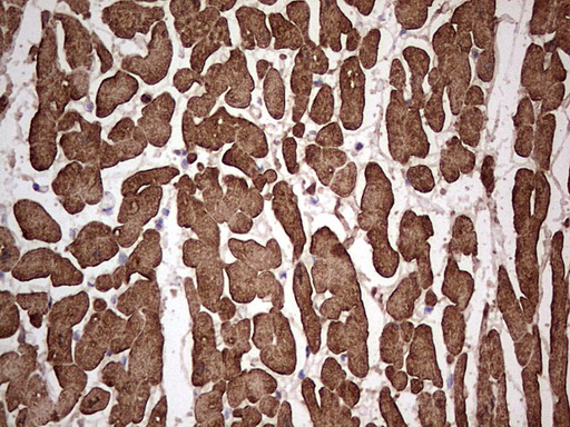 Immunohistochemical staining of paraffin-embedded Human adult heart tissue using anti-TNNC1 mouse monoclonal antibody